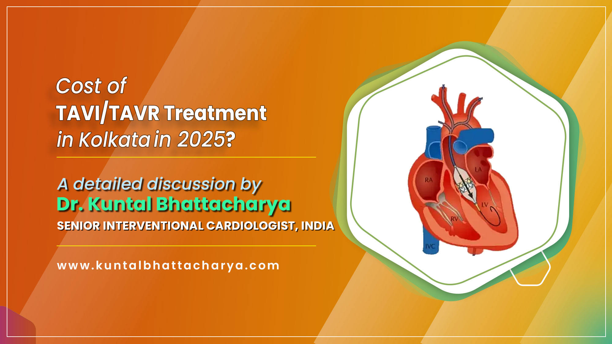 TAVI/TAVR implantation in Kolkata in 2026: Procedures, Cost & Other details